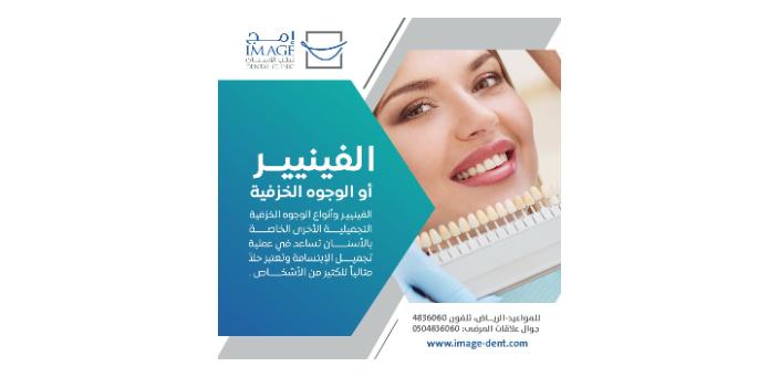 ⁧‫الفينيير